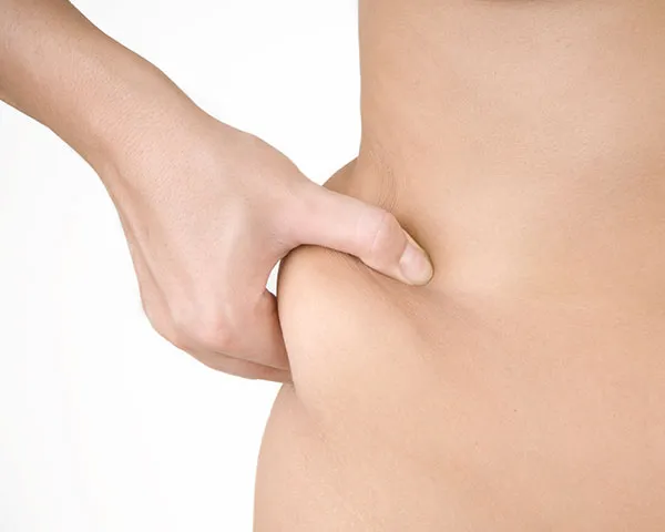 Excess Body Fat