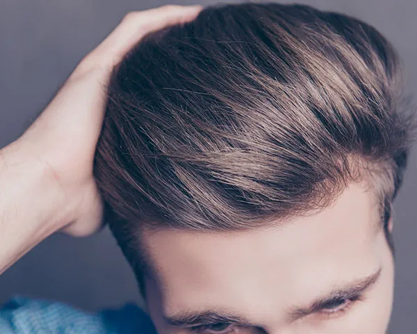 Finasteride (Propecia)