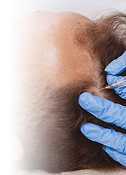 Hair Restoration