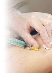 sclerotherapy