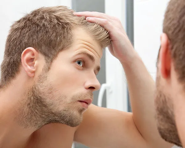 Hair Loss for Men