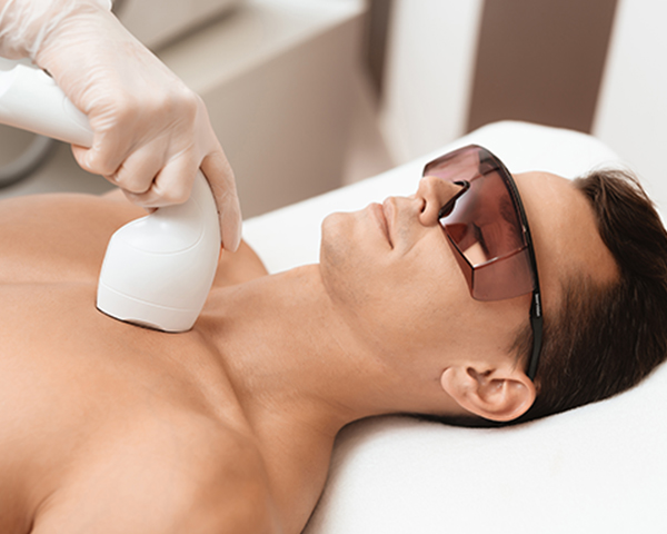 Hair Removal for Men