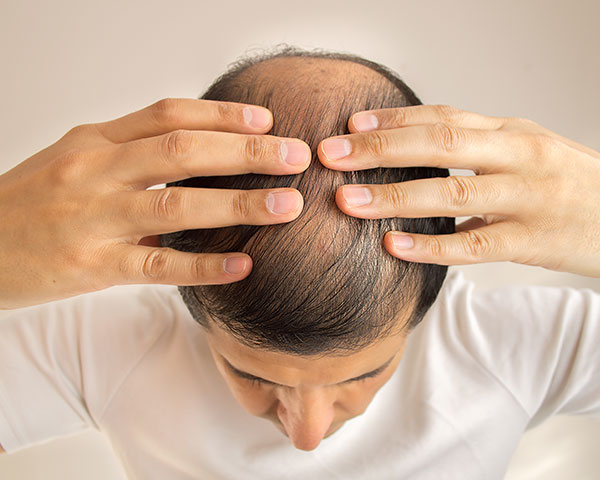 Hair Restoration