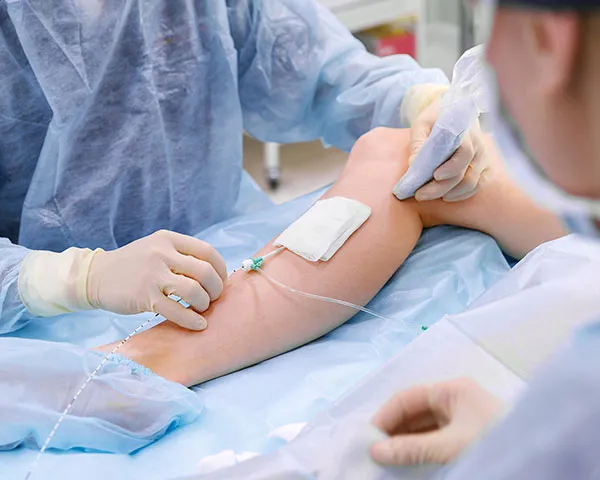 Radiofrequency Ablation Sclerotherapy