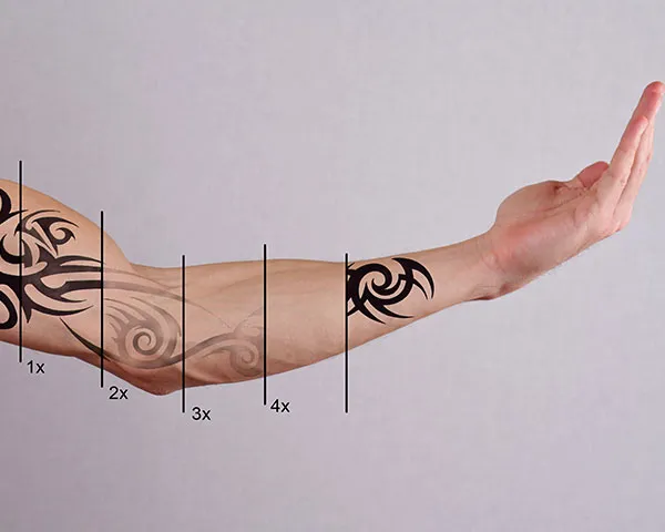 Tattoo Removal Jersey City