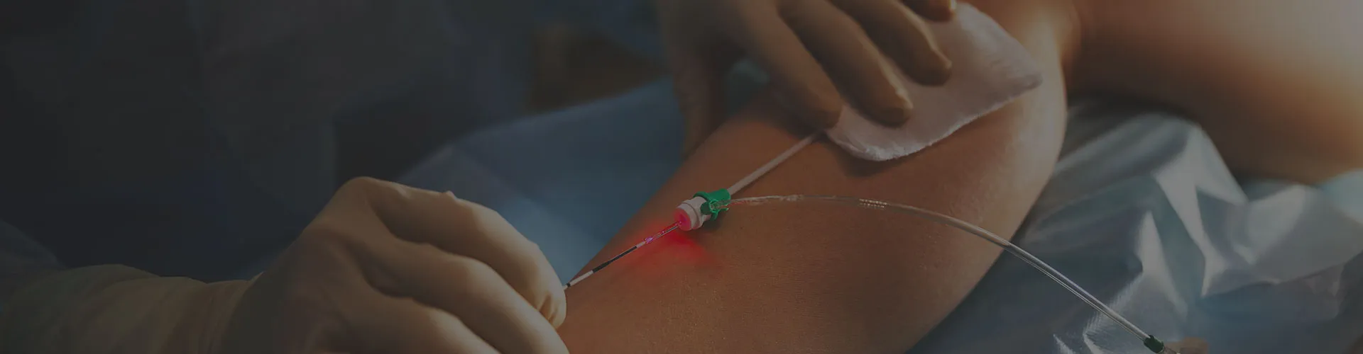 Vein Treatments Jersey City